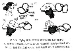 耳石症康复训练操(耳石症康复训练操视频)