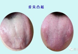 李茂发治疗漏尿遗尿(李茂发治漏尿最经典十句话)