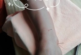 李茂发针灸治疗颈椎病(李茂发针灸治疗颈椎病视频)