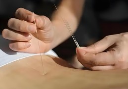 京骨透涌泉的针灸视频(李茂发京骨透涌泉针灸演示)